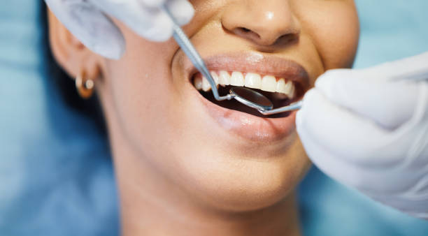 Best Dental Bonding  in USA